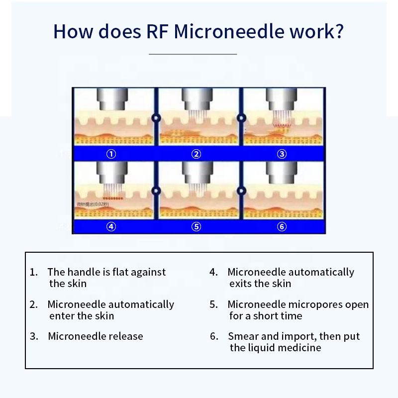 radio frequency facial lifting firming vacuum system rf micro-needle machine