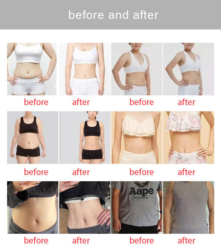 Vacuum Therapy Slimming Roller Vacuum Machine Rf Face Lift Body Shape Vacuum Terapi Par Celulitis Machine