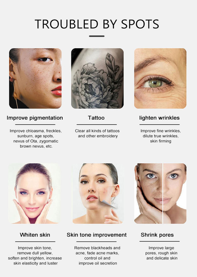 Q switch nd yag laser color tattoo inks remove picosecond pigmentation removal carbon peeling laser beauty machine system Acne Treatment Machine