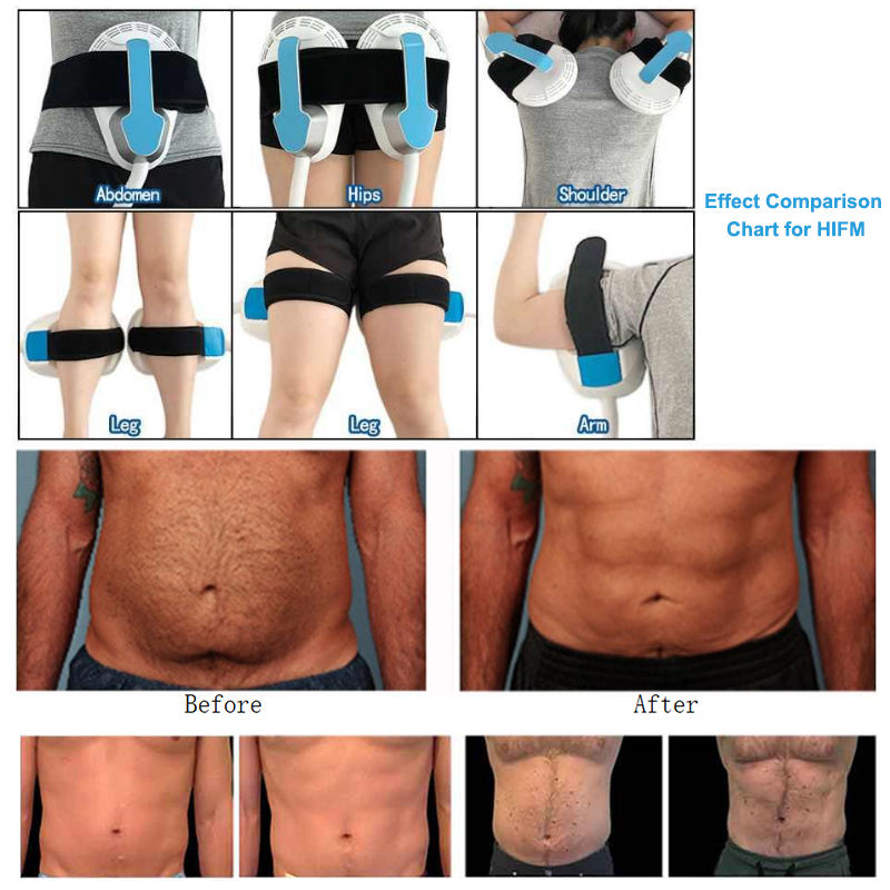 Emslim Inner Ball Roller Body Shaping Machine EMS RF Muscle Building Cellulite Reduction Roller Massage Slimming Device