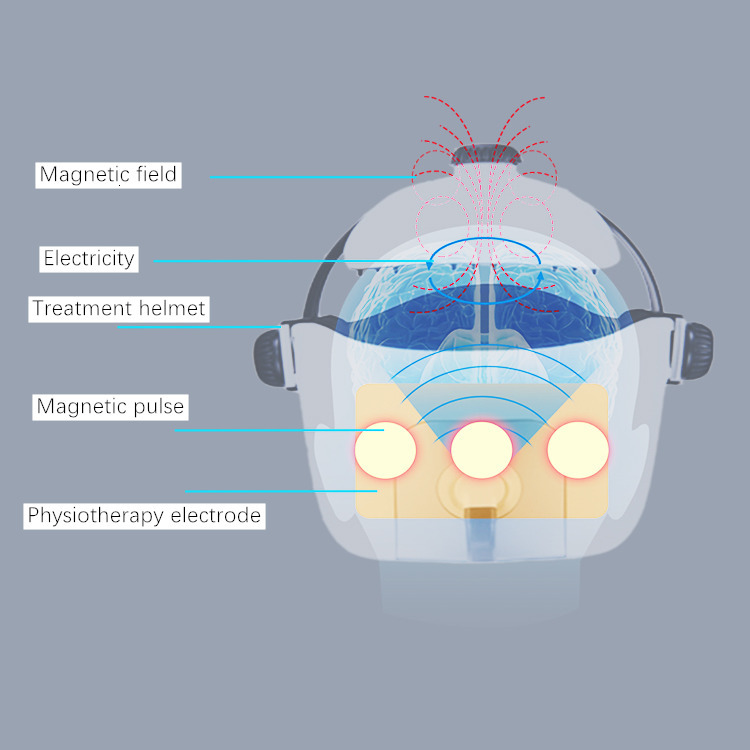 Back Massager Rtms Transcranial Magnetic Stimulation for Stroke adult and Children Insomnia Anxiety Depression Autism Brain Therapy Apparatus 230718