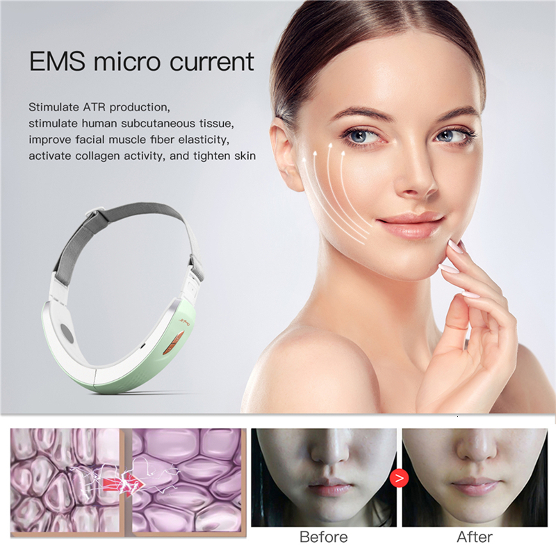 Face Care Devices CkeyiN Chin V-Line Up Lift Belt Machine Blue LED Pon Therapy EMS Face Lifting Slimming Vibration Massager Double Chin Reducer 230718