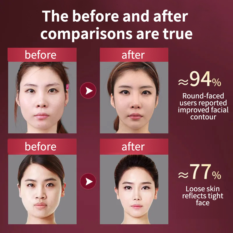 Face Care Devices Lifting Device LED Pon Therapy Slimming Vibration Massager Double Chin V-shaped Cheek Lift Face 230717