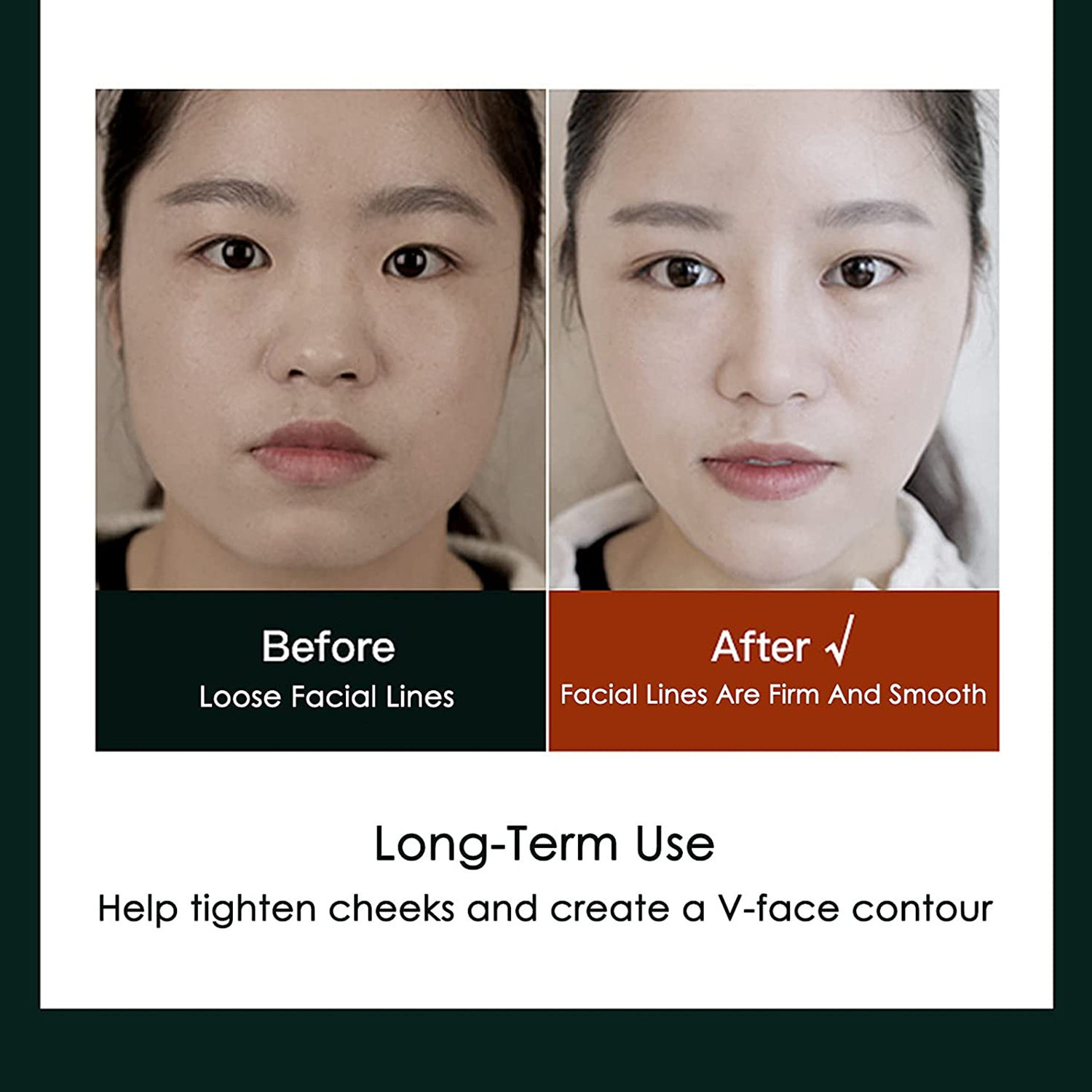 Face Care Devices Electric V-Face Shaping Massager Lifting Neck Anti-Wrinkle Red Blue-Ray Double Chin Shaping Beauty Instrument with RemoteControl 230