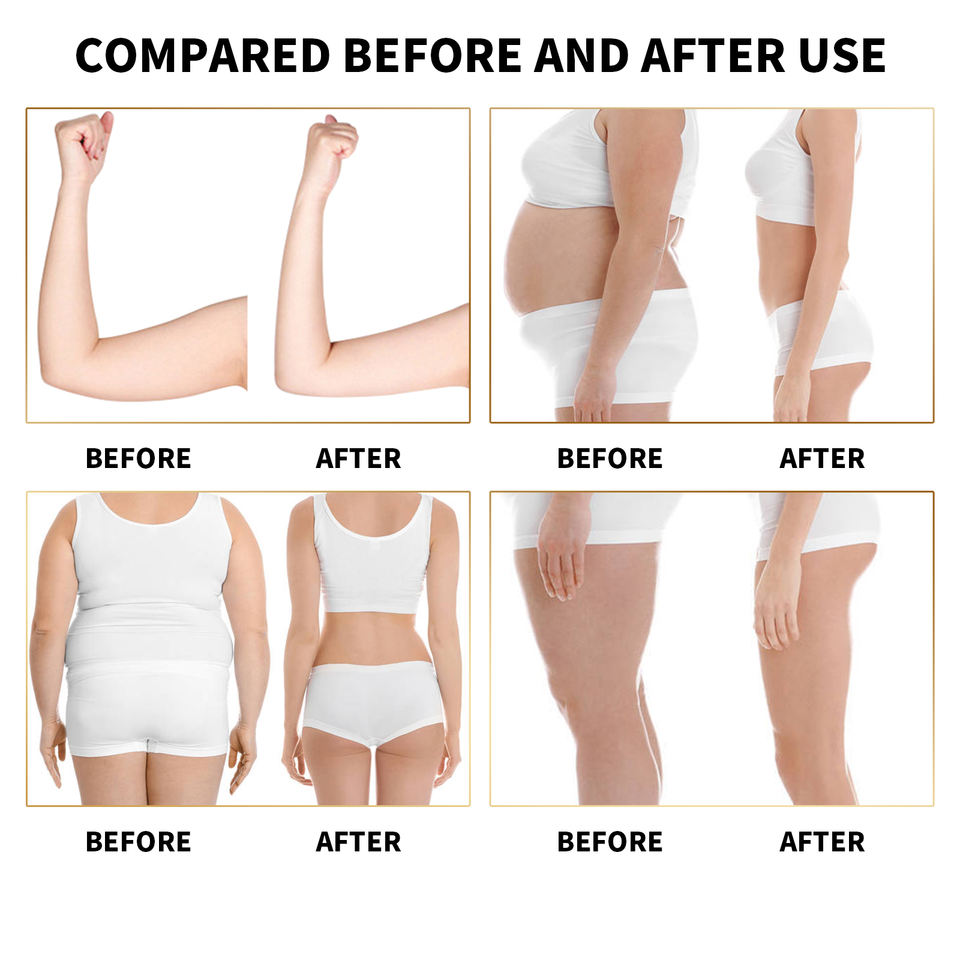 5 Handles Vertical Body Shaping Skin Rejuvenation Cellulite Weight Loss Vacuum Cavitation Roller Rf Velaslim Machine