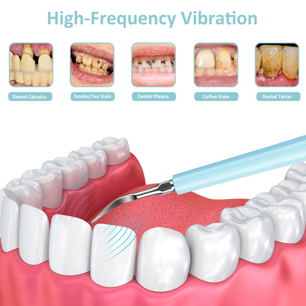 Toothbrush Electric ultrasonic dental scale calculus tooth remover cleaning agent high-frequency tooth staining Tatar tool tooth whitening tool 230720