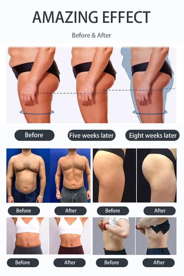 New Arrival 2023 Ems Body Slimming Machine For Body Shaping EMS Sculpting Device