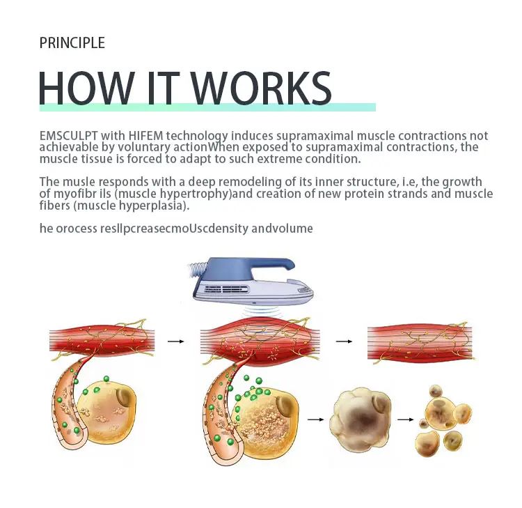 New Arrival 2023 Ems Body Slimming Machine For Body Shaping EMS Sculpting Device