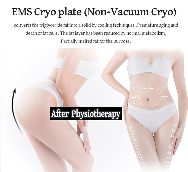 Newest Cryo Plate Cool Body fast Freeze cryotherapy Frozen Burst Fat Slimming EMS Slimming Machine