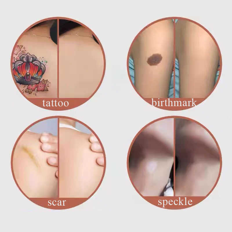 5 PC Temporary Tattoos New 6PCS Tattoo Cover Up Skin Color Scar Concealer Sticker Portable Flaw Birthmark Concealing Waterproof Beauty Cosmetic Tools 