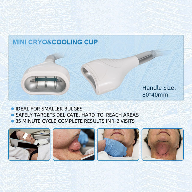 360 cryolipolysis fat removal cavitation RF body slimming Lipo laser loss weight Body Contouring Cellulite removal machine