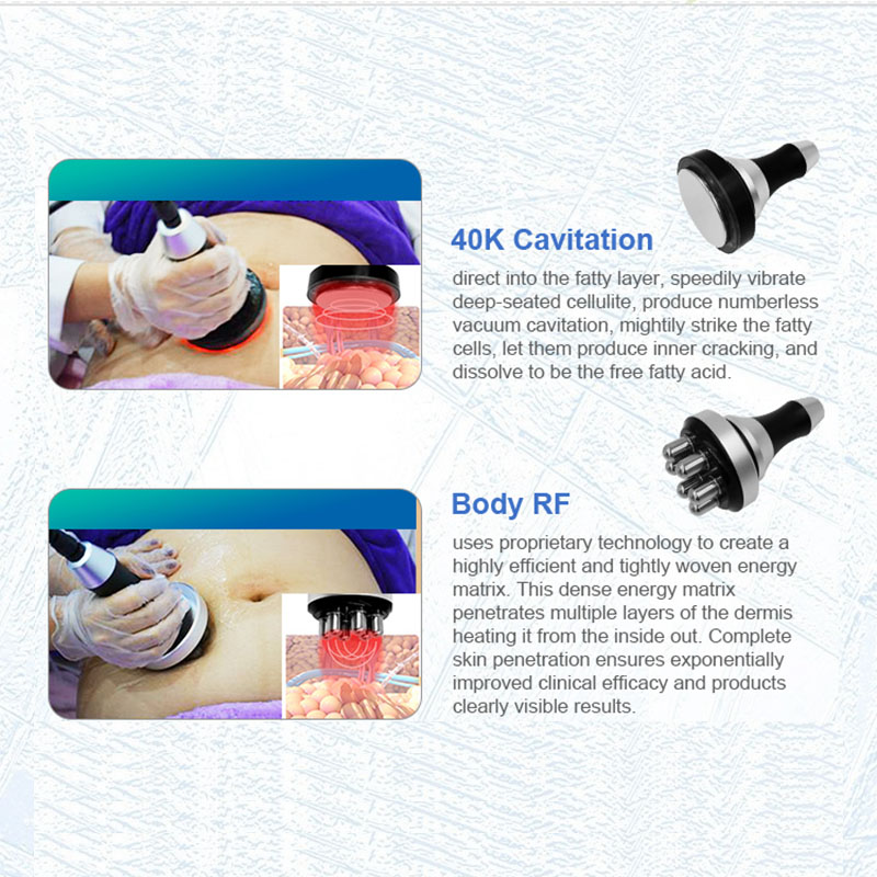 360 cryolipolysis fat removal cavitation RF body slimming Lipo laser loss weight Body Contouring Cellulite removal machine