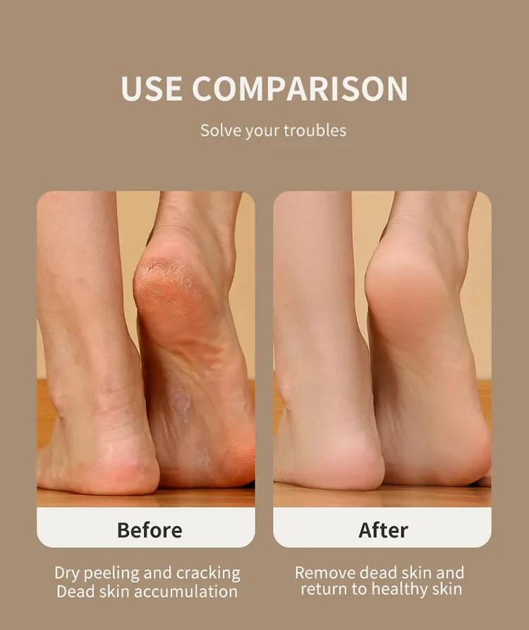 LED Screen Foot Grinder Wirelss Dead Skin Callus Remover Mini Foot Drill 1600rpm 2000rpm 2800rpm with 3 Grinding Heads