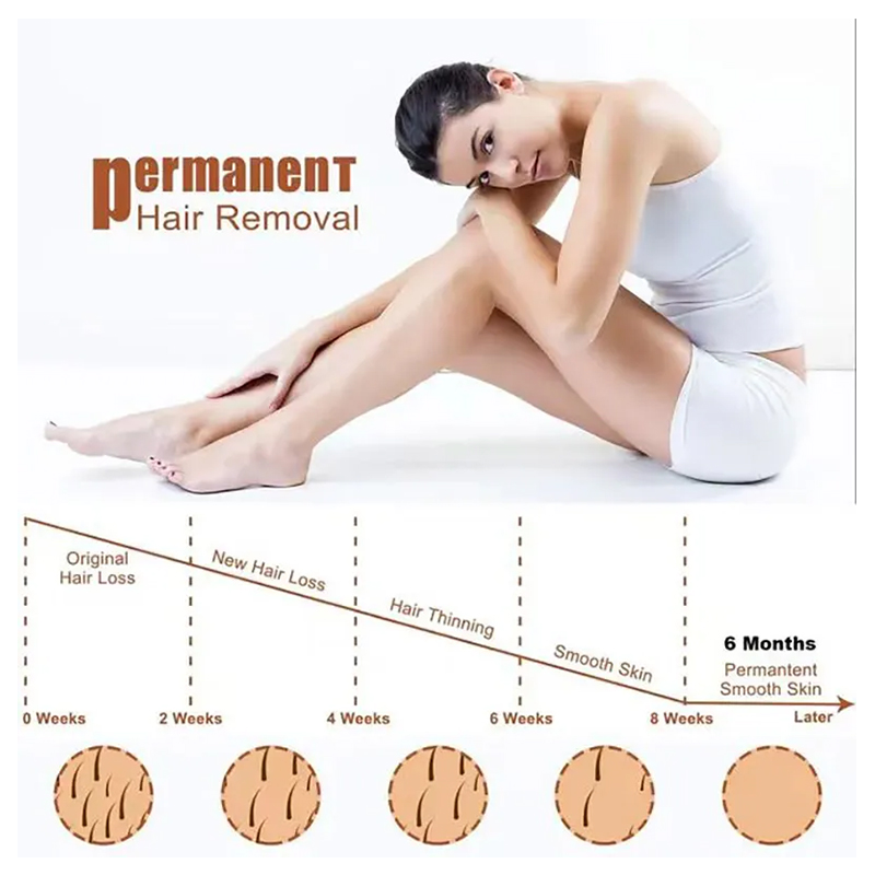Hot Selling Diode Laser Hair Removal Machine 755 808 1064 Laser Fast Hair Removal Skin Rejuvenation Whitening Acne Treatment
