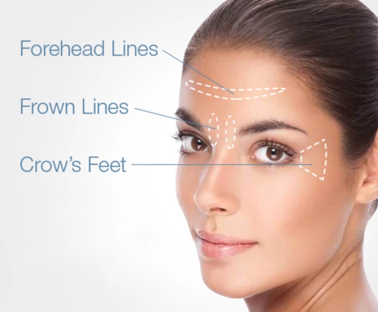 Face care devices wrinkle-removal for body derma meso salon juydms cream vollummes for face skin rejuvenation juvvydms skin care creams ulltras
Face care devices wrinkle-removal for body derma meso salon juydms cream vollummes for face skin rejuvenation juvvydms skin care creams ulltras