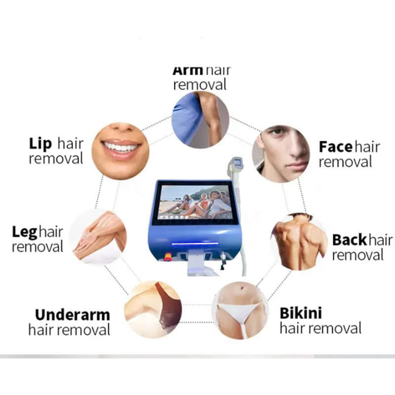 2025 Newest 808Nm Diode Hair Removal Machine 808 755 1064 Permanent Hair Remover Equipment Painless Body Epilator Devic