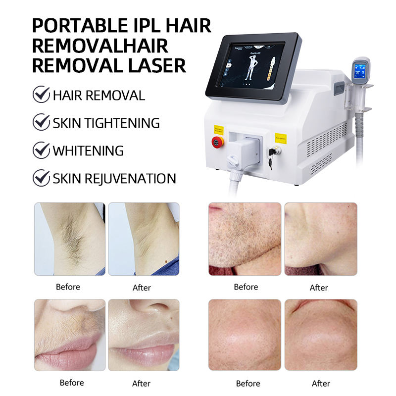 Portable Ice Titanium Beauty System Diode Laser Hair Removal 755 Nm 808 Nm 1064 Nm Machin