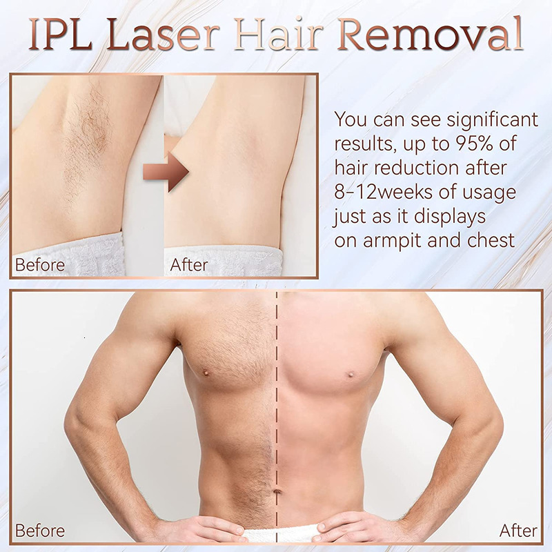 Epilator 999999 Flashes IPL Laser Epilator for Women Home Use Devices Hair Removal Painless Electric Epilator Bikini Drop 230428