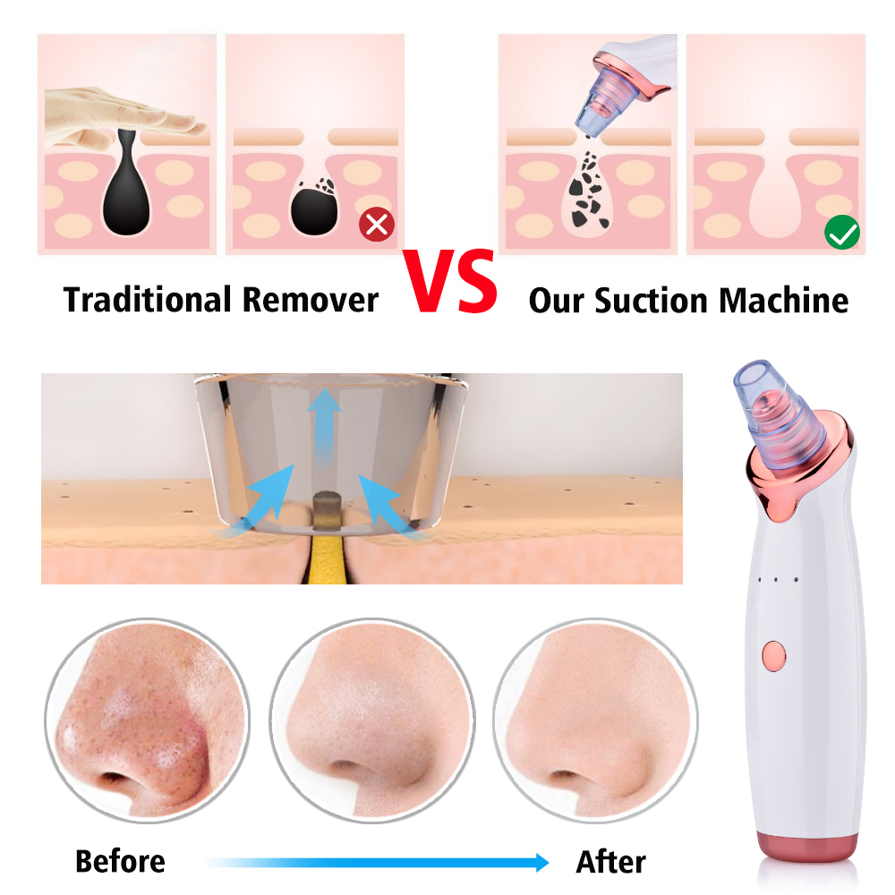 Face Care Devices Blackhead Remover Vacuum Electric Nose Beauty Face Deep Cleansing Skin Care Vacuum Black Spots Acne Pore Cleaner Pimple Tool 230411