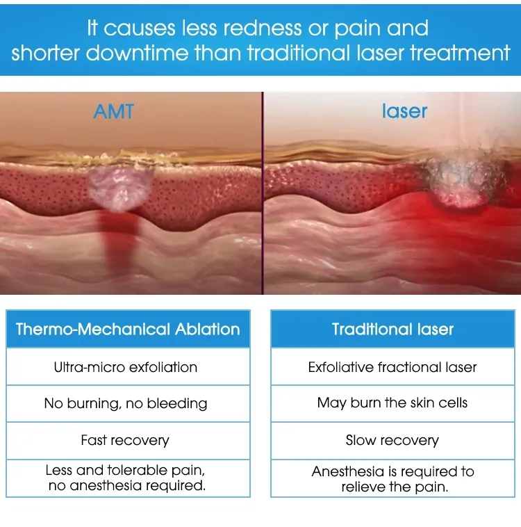 rf microneedling pixel tixel oder not laser 8 fractional beauty skin machine recover treatment acne scars fine line removal reddit resurfacing with on