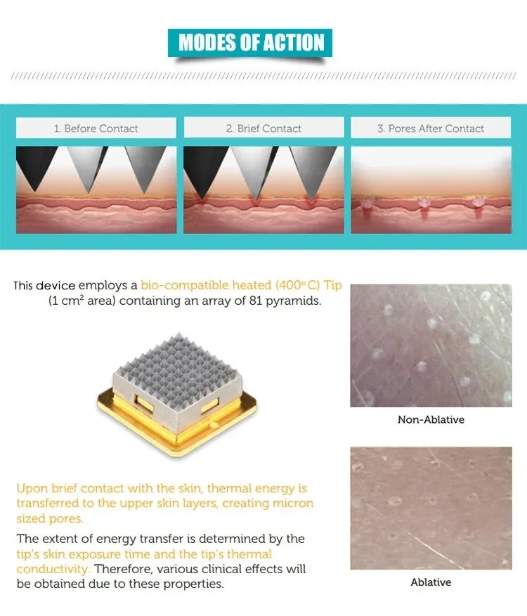 rf microneedling pixel tixel oder not laser 8 fractional beauty skin machine recover treatment acne scars fine line removal reddit resurfacing with on