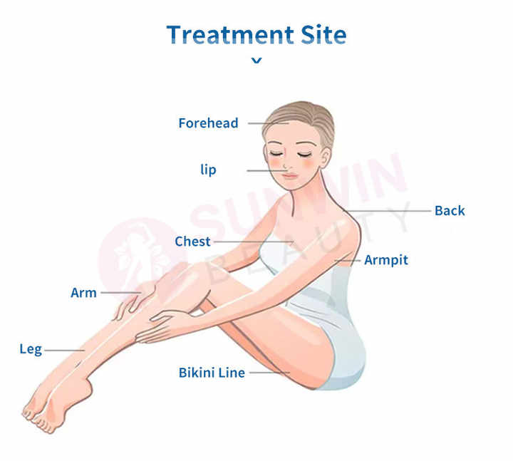 Laser Epilator DPL IPL Laser Hair Removal Device Acne Treatment Skin Rejuvenation Vascular Removal Freckle Removal