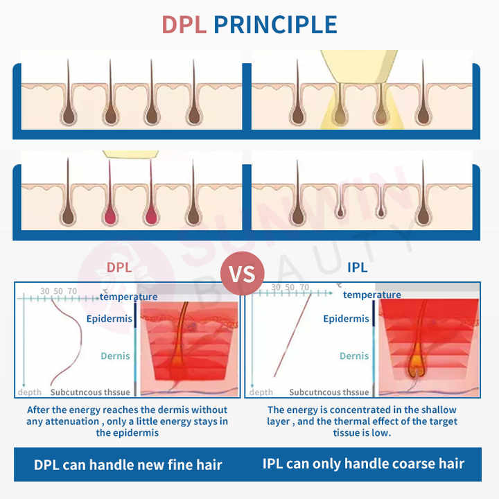 Laser Epilator DPL IPL Laser Hair Removal Device Acne Treatment Skin Rejuvenation Vascular Removal Freckle Removal