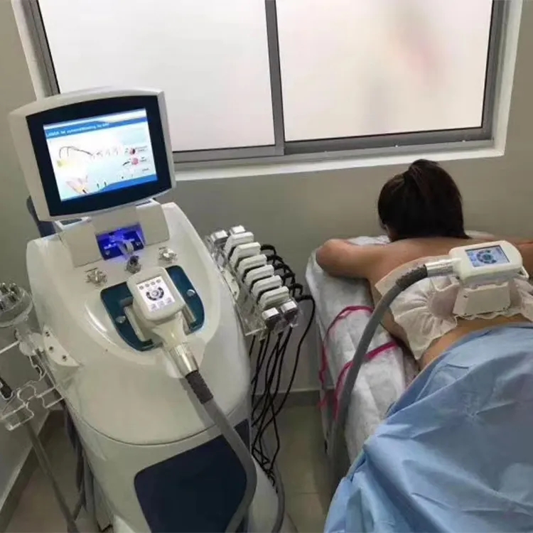 5 In 1 Roller shaping Cryo 40K RF Machine Body Skin Lifting Treatment Vacuum