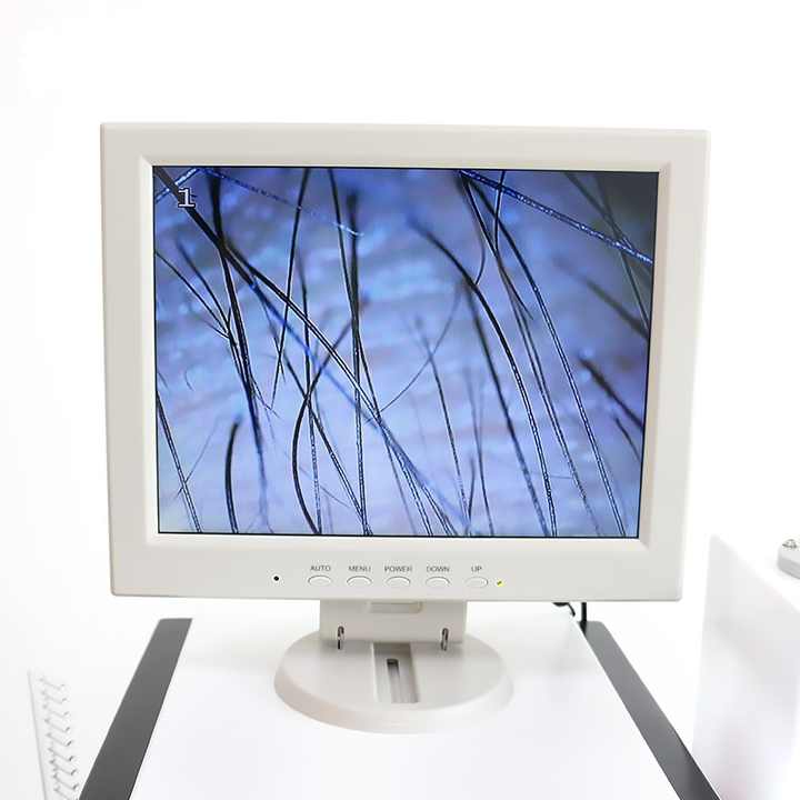 Desktop Diode Laser Hair Regrowth Equipment 650nm Anti Hair Loss Scalp Nursing 5 in 1 Hair Oil Control Apparatus with Detection Camera