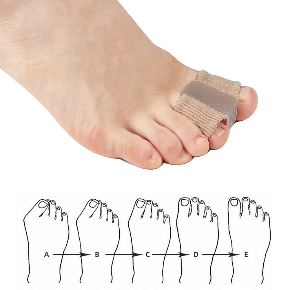 Shoe Parts Accessories 1PC Bunion Device Hallux Valgus Orthopedic Braces Toe Correction Night Foot Care Corrector Thumb Goodnight Daily Big Bone Tools