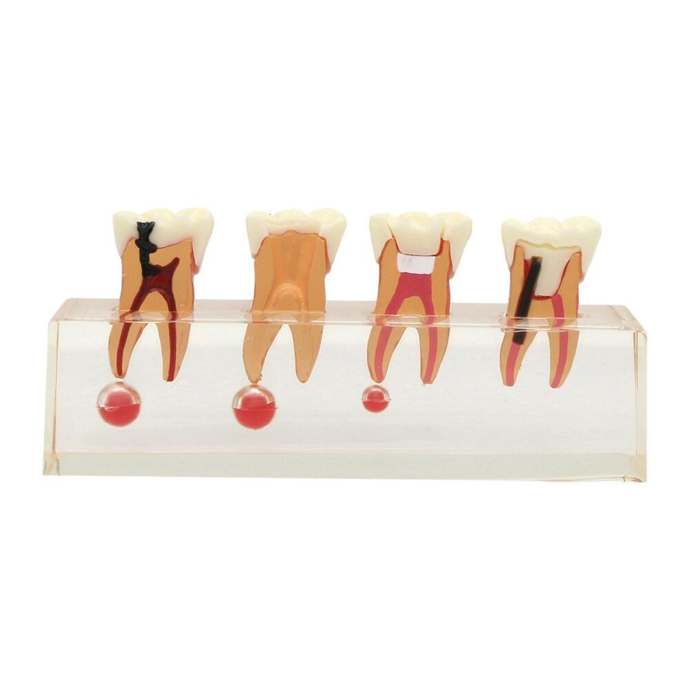 Dental Floss Pathological Typodont Teeth Model PeriodonticsImplantEndodontic Caries dental 230421