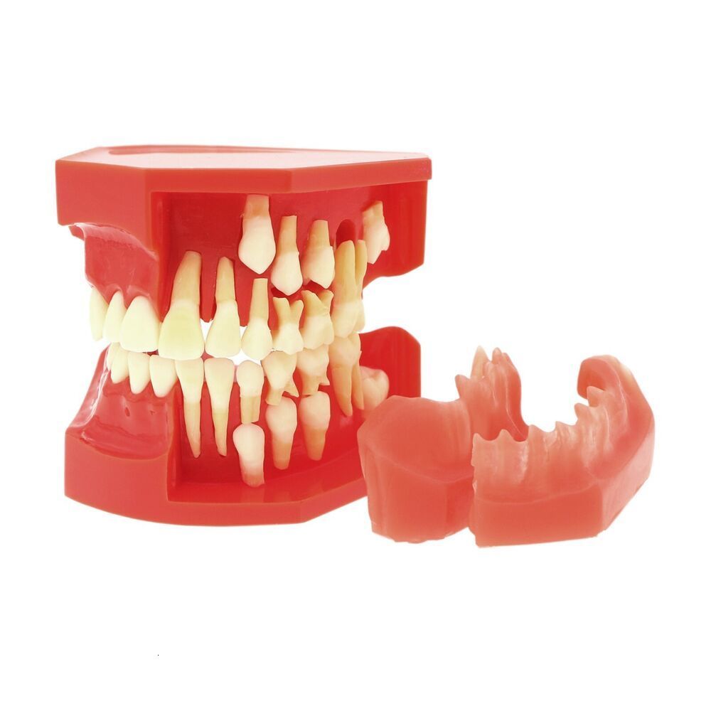 Dental Floss Pathological Typodont Teeth Model PeriodonticsImplantEndodontic Caries dental 230421