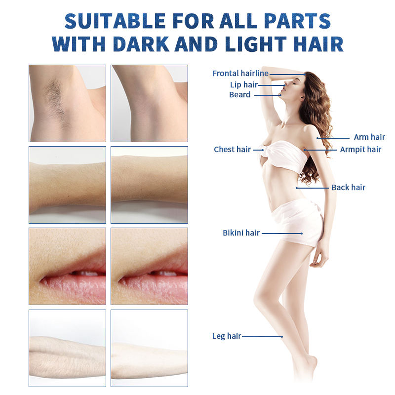 Risk-free Painless Hair Removal Machine 755nm 808nm 1064nm Diode Laser Skin Rejuvenation Depilatory Hair Remove Acne Clearance Desktop Salon