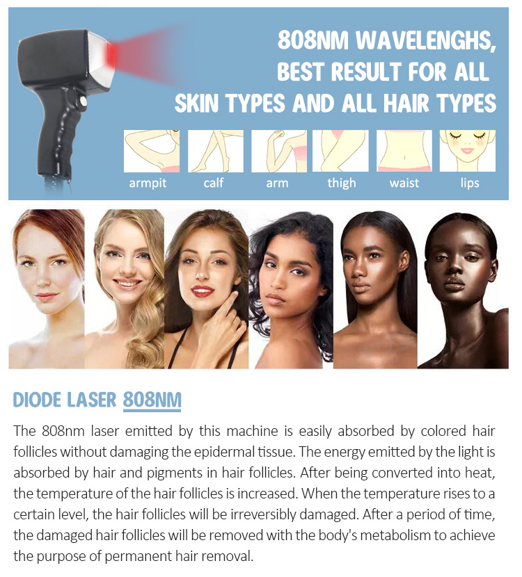 soprana Ice Titanium 808nm Hair Removal Permanent Alexandrite 755nm 808 1064 Diode Laser Hair Removal Machine