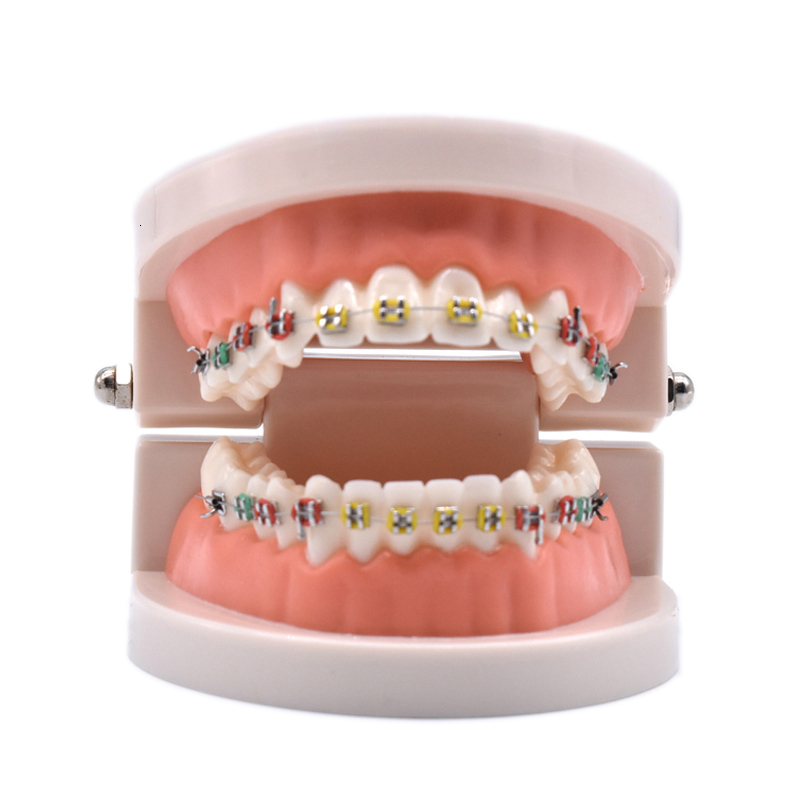 Other Oral Hygiene Dental Orthodontic Treatment Model With Ortho Metal Ceramic Bracket Arch Wire Buccal Tube Ligature Ties Dental Tools Dentist Lab 230425
Other Oral Hygiene Dental Orthodontic Treatment Model With Ortho Metal Ceramic Bracket Arch Wire Buccal Tube Ligature Ties Dental Tools Dentist Lab 230425