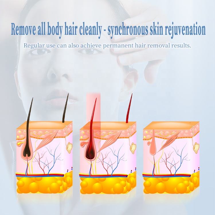 Fashionable Black Desktop Hair Removal Follicle Damage Permanent Depilation 808 Diode Laser Skin Firming Salon with Ice Point Skin Cooling System