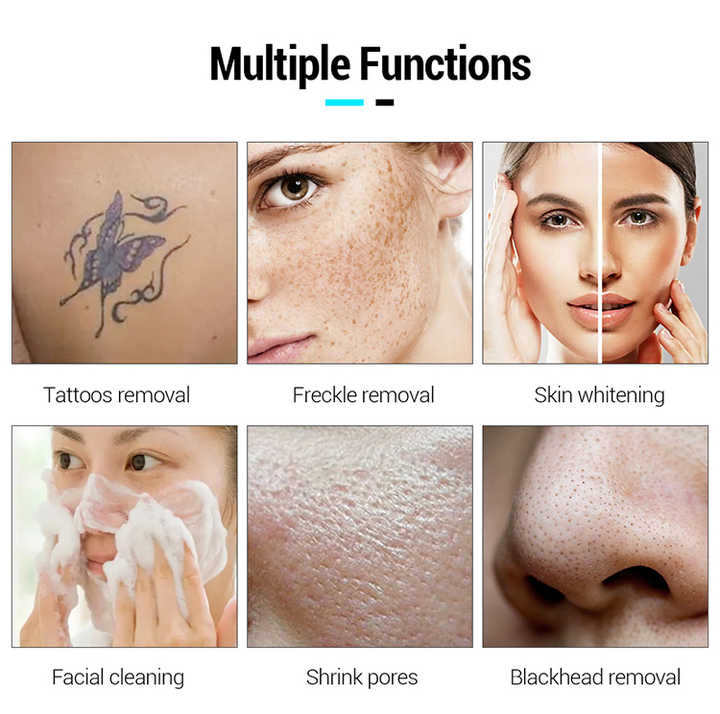 Vertical picosecond laser spectra picolaser the costing remove tattoo q switched nd yag laser picosegundos laser tattoo removal