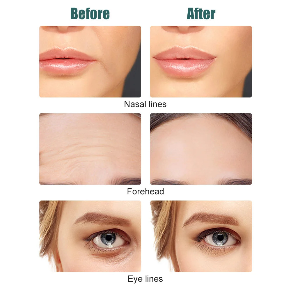 Face Care Devices 3D Roller EMS Micro Current Tighten Skin Firming Face-lifting Device Skin Remove Edema Fades Fine Lines Massager 231128