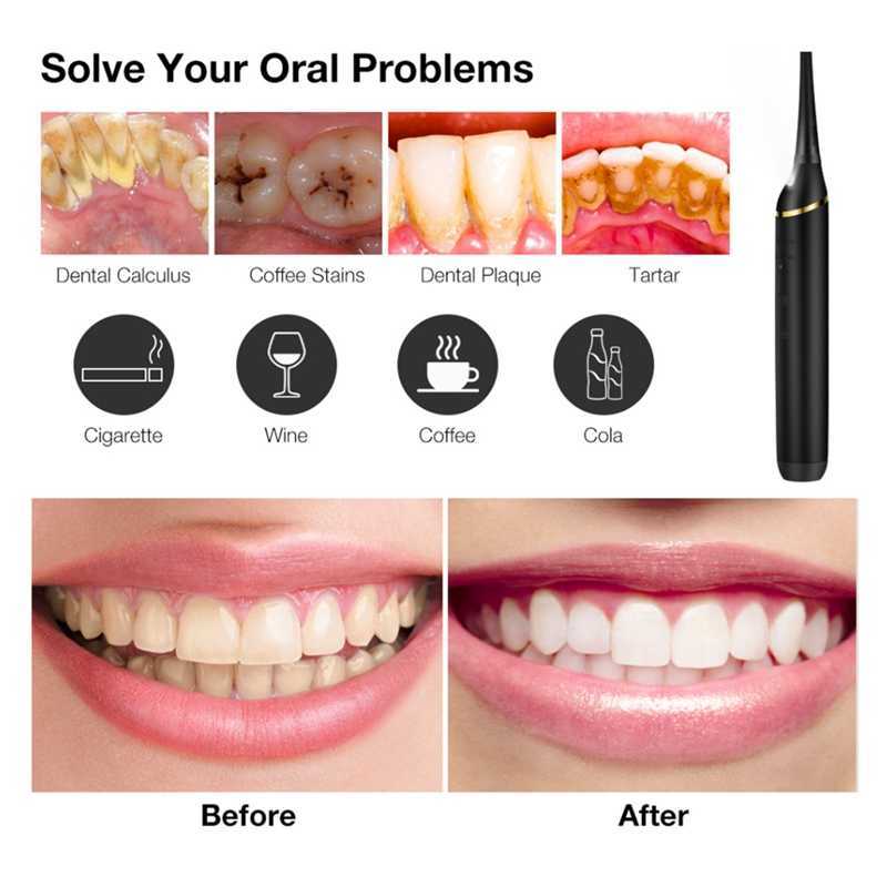 Oral Irrigators Other Hygiene Moving Calculus Remover Sonic Tooth Cleaner Irrigator Household Stains Tartar Tool Whitening 221215