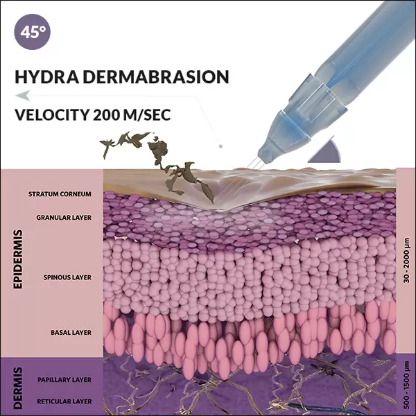 Oxygen Health Jet Peel water machine hydra dermabrasion anti-wrinkle beauty machine for high pressure Non-invasive injection