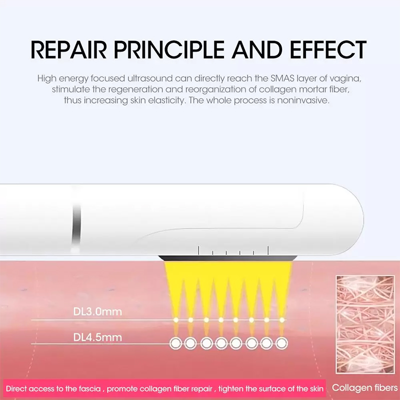 Other Beauty Equipment Hifu Vaginal Rejuvenation Tightening Machines Wrinkle Removal Machine for sale