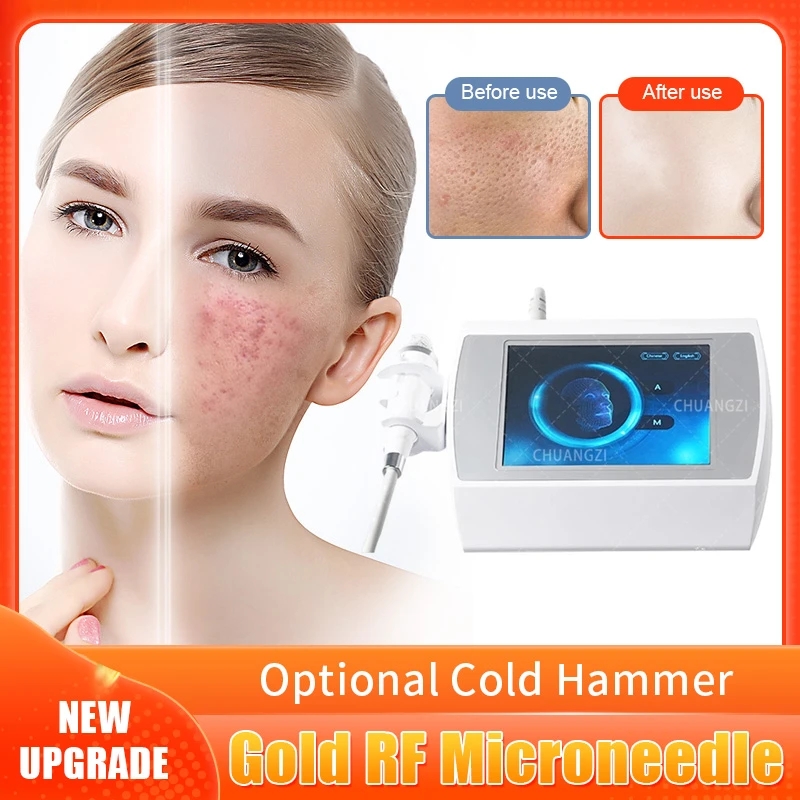 Other Beauty Equipment 2023 Fractional Radio Frequency device Fractional Gold RF Microneedling Anti Aging Microneedle Skin Care Tightening Anti Wrinkle Scar
Other Beauty Equipment 2023 Fractional Radio Frequency device Fractional Gold RF Microneedling Anti Aging Microneedle Skin Care Tightening Anti Wrinkle Scar