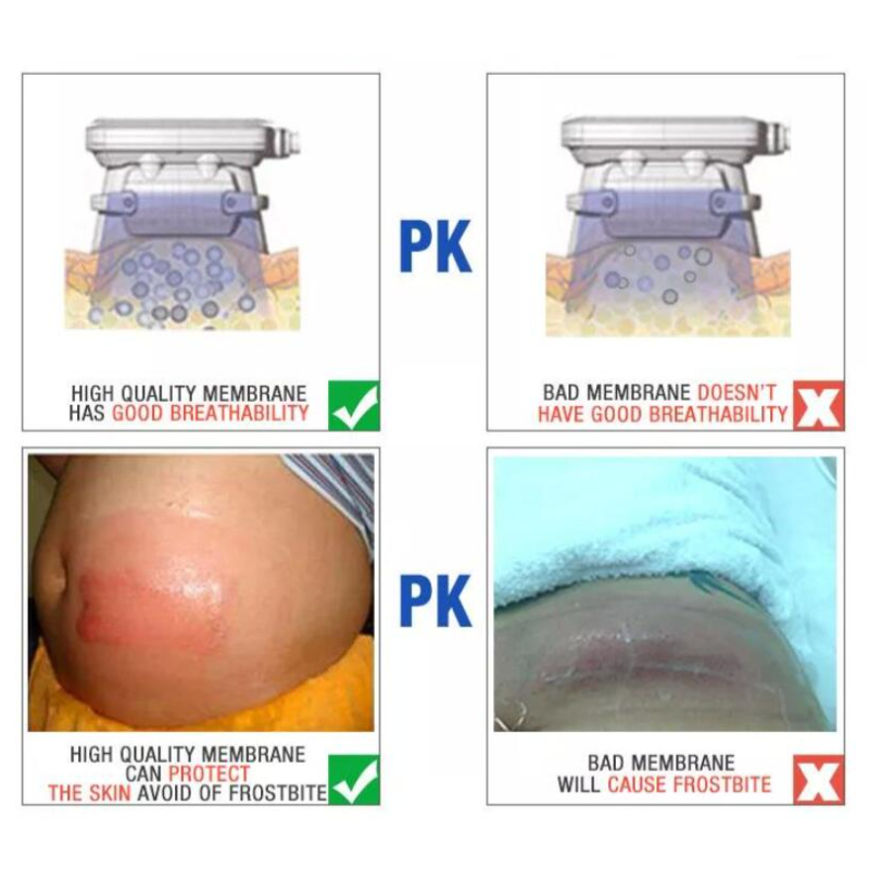 Accessories & Parts High Quality Cool Cryotherapy Antifreeze Membrane Cryolipolysis Pads Price For Fat Freezing Machine