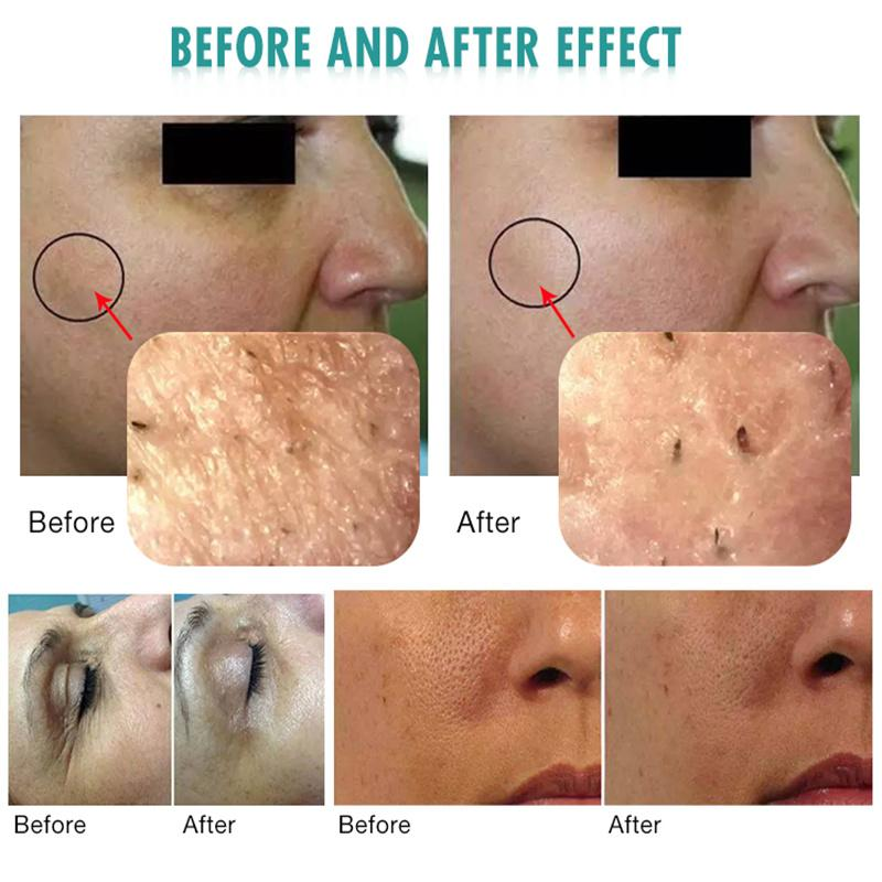 Stock in European Deep Cleaning Collagen Skin Rejuvenation And Brightening Glowskin O Care Gel Shiny Rehydrate Exfoliation Lighteniing Set