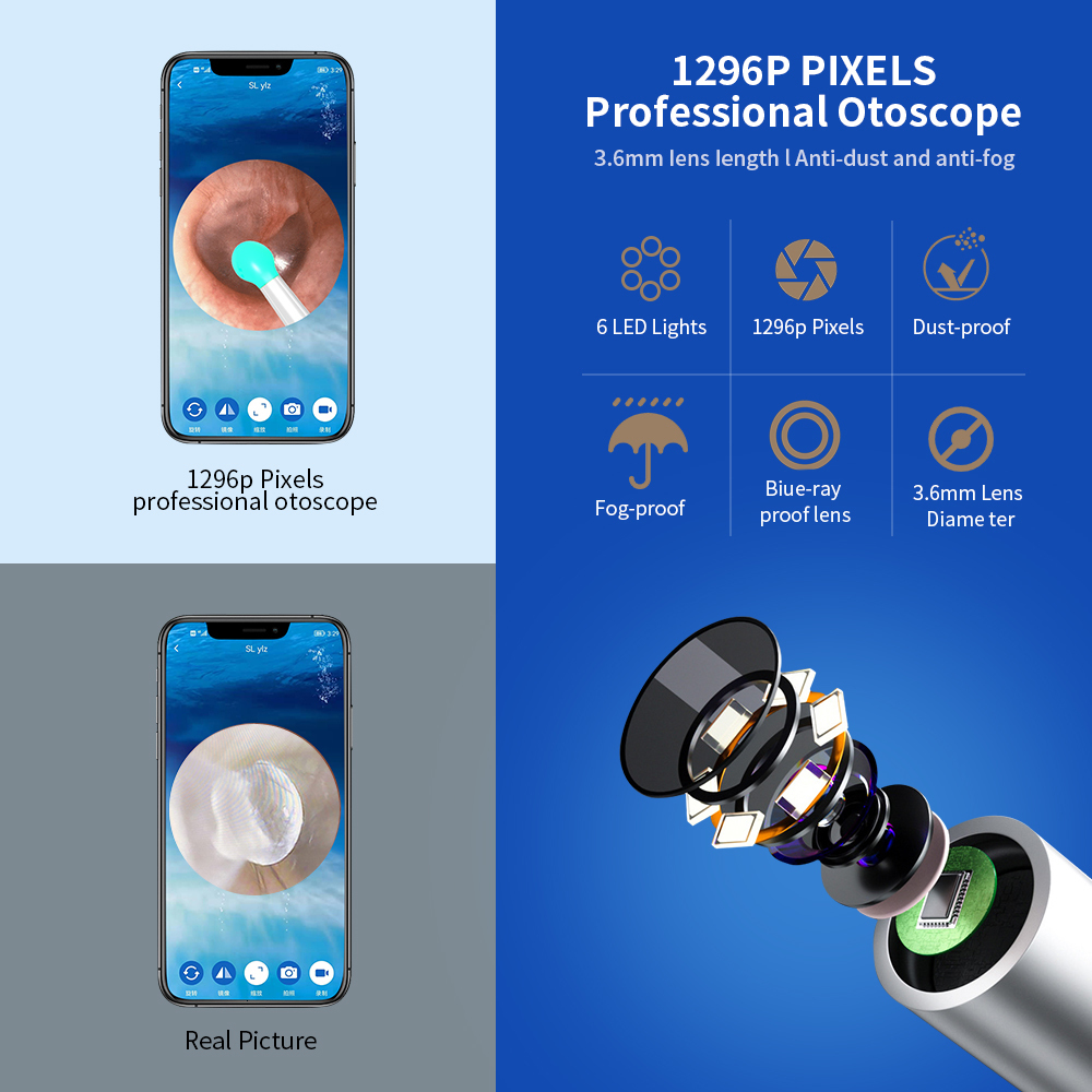 Ear Care Supply NATFIRE NE3 Ear Cleaner High Precision Ear Wax Removal Tool with Camera LED Light Wireless Otoscope Smart Ear Cleaning Kit 230222