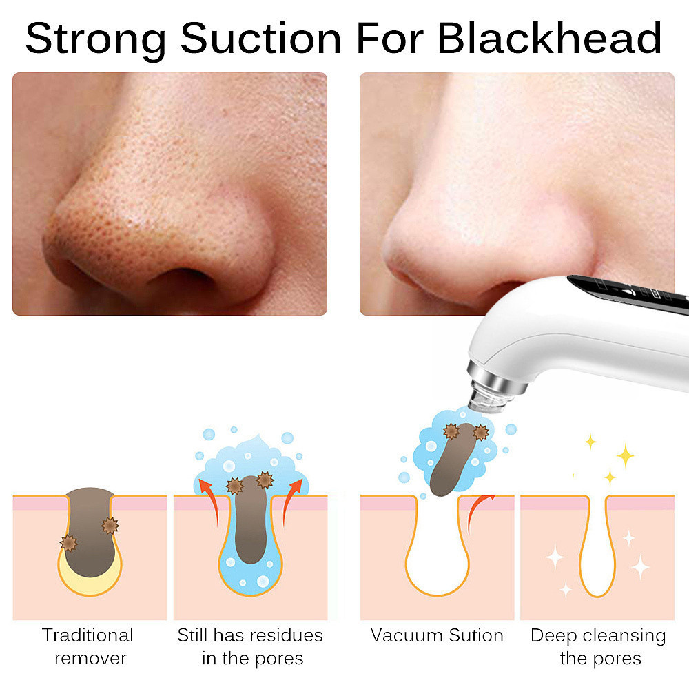Face Care Devices Blackhead Remover Pore Vacuum Face Cleaner Electric Pimple Black Head Removal USB Rechargeable Water Cycle Cleaning Tools 230222