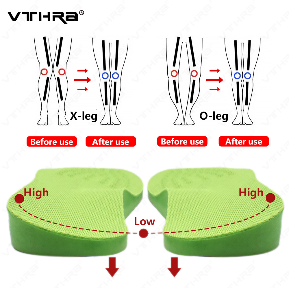 Shoe Parts Accessories O/X-Leg Orthopedic Insoles Arch Support Insole Corrigibil Bow Legs Valgus Varus Massaging Shoe Pads Beauty Leg Feet Care Insert 230225
Shoe Parts Accessories O/X-Leg Orthopedic Insoles Arch Support Insole Corrigibil Bow Legs Valgus Varus Massaging Shoe Pads Beauty Leg Feet Care Insert 230225