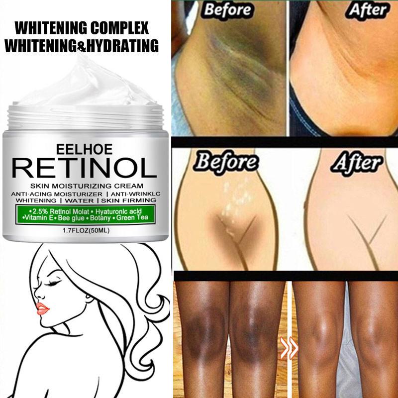 Accessories Body Melanin Removal Cream Whitening Knee Buttocks Lightening Melanin Removal Dark Spot Whitening Skin Care Products
Accessories Body Melanin Removal Cream Whitening Knee Buttocks Lightening Melanin Removal Dark Spot Whitening Skin Care Products