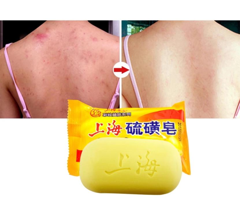 85g Shanghai Sulfur Soap Oil Control Acne Treatment Psoriasis Seborrhea Eczema Anti Fungus Bath Healthy Soap1246475
85g Shanghai Sulfur Soap Oil Control Acne Treatment Psoriasis Seborrhea Eczema Anti Fungus Bath Healthy Soap1246475
