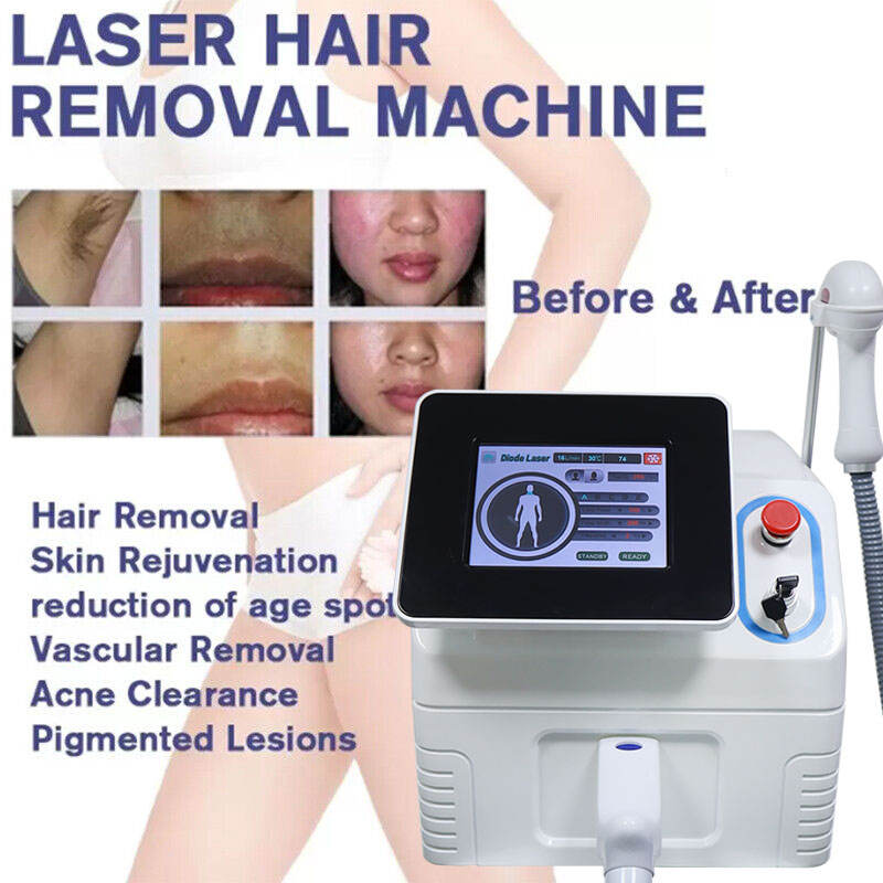 2023 808nm Diode Hair Removal Machine 3 Wavelength Permanent Depilation Hair Removal Painless